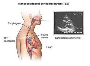 PCardio_20140402_v0_003