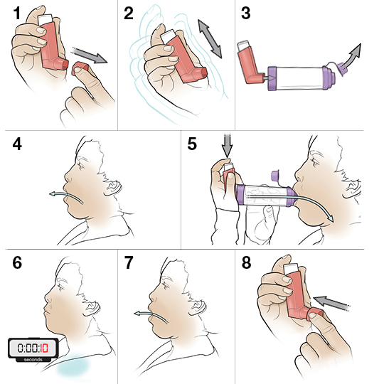 8 steps in using a metered-dose inhaler with a spacer