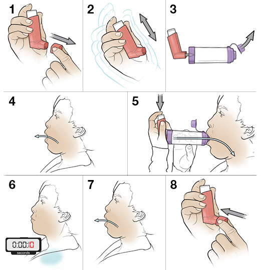 Step-by-Step: Using an Inhaler with a Spacer | YourCareEverywhere