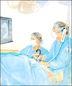 A camera attached to the arthroscope allows your doctor to see your knee joint on a monitor.