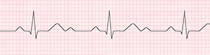 An ECG recording of a regular heartbeat.
