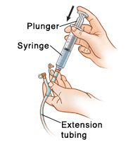 Closeup of hand holding extension tubing with syringe inserted in port. Other hand is pressing down plunger on syringe.