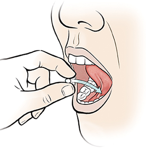 Closeup of mouth showing fingers placing pill under tongue.
