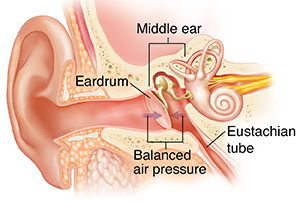 Cross section of ear showing outer, inner, and middle ear structures with behind-the-ear hearing aid in place with inset of external view.