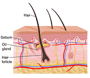 Cross section of skin showing dermis and epidermis.