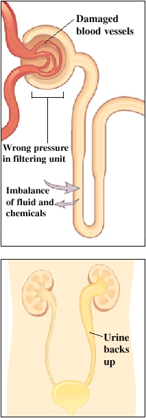 Cutaway view of filtering unit