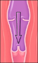Cutaway view of vein