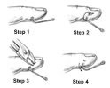 First Aid - Removing a Fishhook