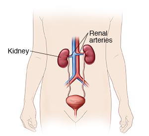 Renal Angiography | YourCareEverywhere
