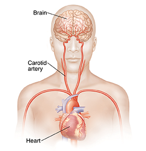 Front view of head and upper body showing carotid arteries, heart, and brain.