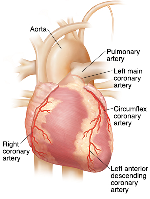 Front view of heart showing coronary arteries.