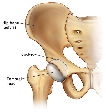 Front view of hip bone (pelvis) showing femoral head of thighbone fitting in socket in pelvis.