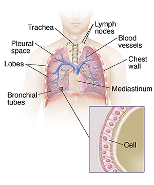 Front view of male chest showing trachea and lungs and inset showing bronchiole cells.