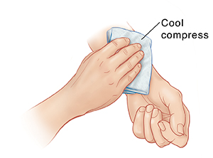 Hand placing ice pack on inner forearm of opposite arm.