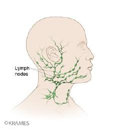 Illustration of the lymphatic system of the head and neck.