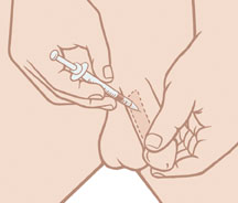 Medication injected into the side of the penis causes an erection. Man injecting medication into penis.