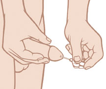 A medicated pellet put into the urethra causes an erection. Man inserting pellet into urethra.