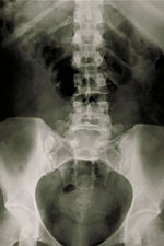 X-ray image of the back and pelvis