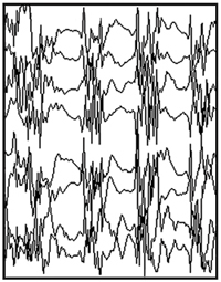 Normal EEG tracing.