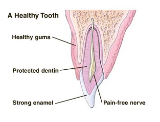 A healthy tooth, showing healthy gums, protected dentin, strong enamel, and pain-free nerve