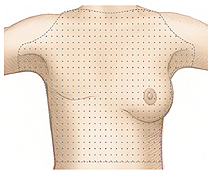 Woman's torso with shading over area to examine after mastectomy.