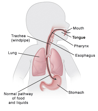 Outline of infant upper digestive system and normal patyway of food and liquids.