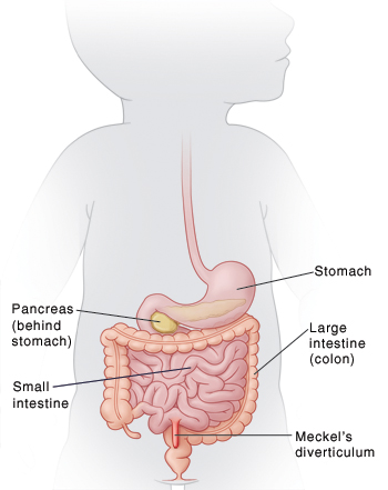 Outline of infant showing digestive system and location of Meckel's diverticulum.