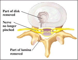 Image of disk