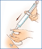 Image of feeding tube