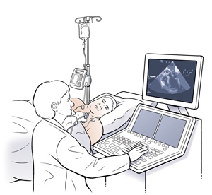 Man lying on side on exam table with EKG leads on chest. Technician is holding ultrasound probe to man's chest. 