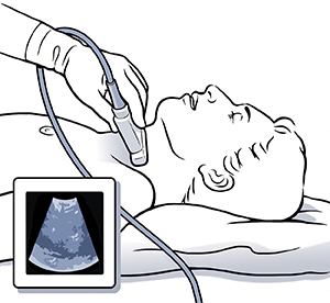 Man's head and neck with healthcare provider's hand holding ultrasound probe to neck. Inset shows ultrasound image.