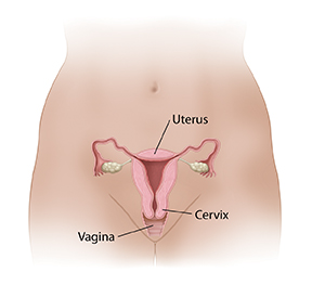 Outline of female pelvis showing uterus, cervix, and vagina.