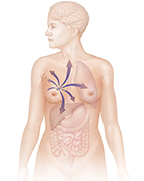 Outline of woman from head to mid-thigh.  Arrows show breast cancer spreading to multiple organs.