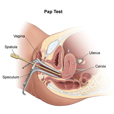 Pap test