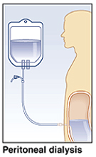 Peritoneal dialysis