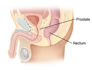 Side view cross section of male pelvis showing the prostate and rectum.