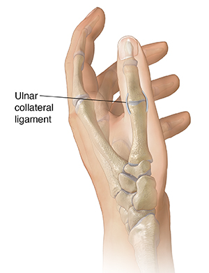 Side view of hand showing ulnar collateral ligament.