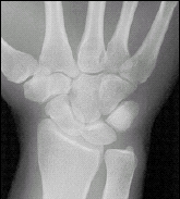 X-ray image.
