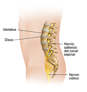 Retirarse Hacer un nombre Plasticidad Causas posibles del dolor en la espalda baja o la pierna