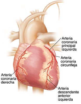 Desconexión atributo Sano Qué es la arteriopatía coronaria