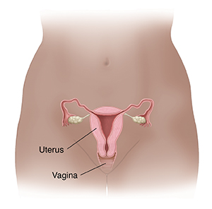 unhealthy cervix