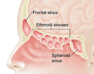 Understanding Your Sinuses