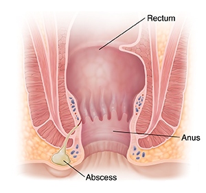 prominent sebaceous glands anus