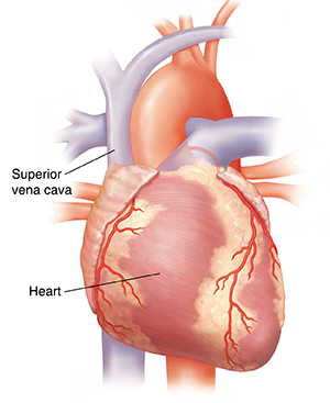 superior vena cava cadaver heart