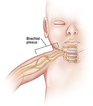 brachial plexus injury in adults