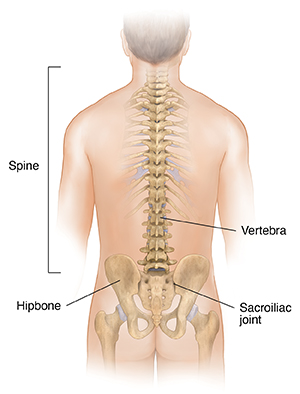 loss of lumbar lordosis due to muscle spasm