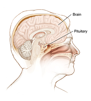 Pituitary Tumors Cedars Sinai