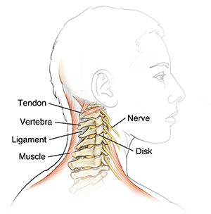 Neck Pain  Cedars-Sinai