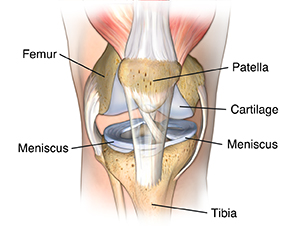 Meniscus Tears: Why You Should Not Let Them Go Untreated