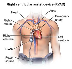 PCardio_20140527_v1_001